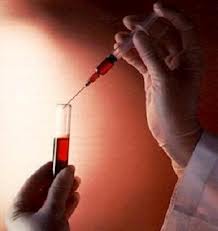 doping 0
