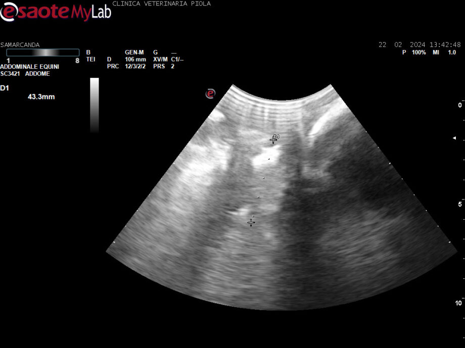 Foto ecografia 13 02 con misurazioni