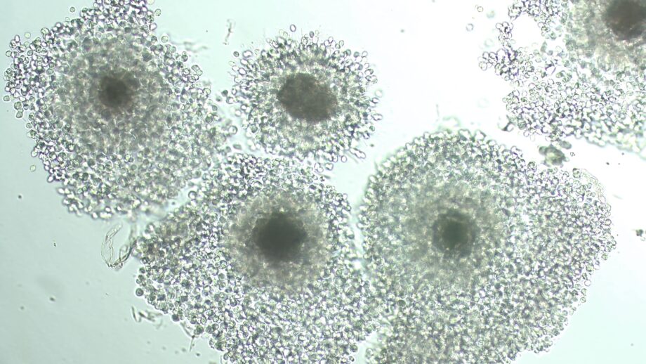 ovocitos maduros 1